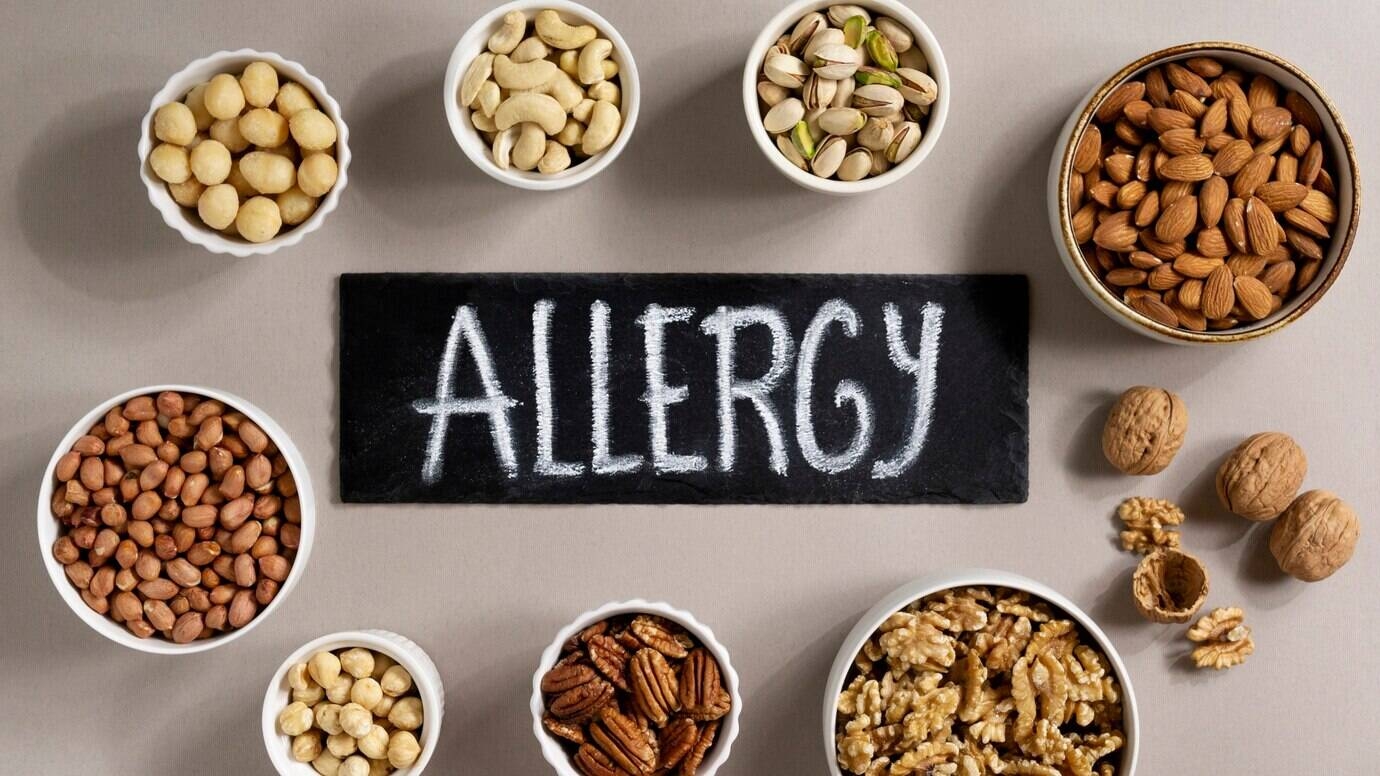 Immagine: Allergie