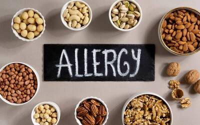 Immagine: Allergie
